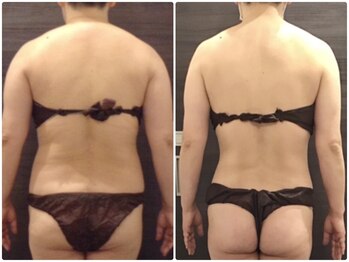 ウェリナ平和堂長久手院/小顔矯正/骨盤矯正/痩身/整体