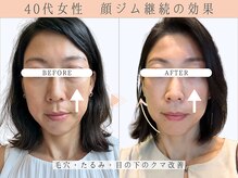 那賀洋子式 顔ジム 大分戸次店/40代女性小顔ジム継続の効果