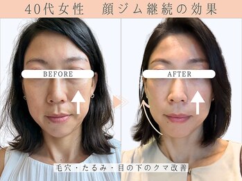 那賀洋子式 顔ジム 大分戸次店/40代女性小顔ジム継続の効果