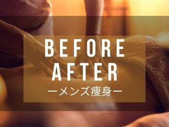 メディカルエステサロン ローズ 金沢本店(ROSE)/メンズ痩身ビフォーアフター