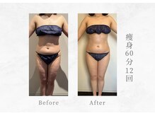 エヴァーグレース 三河安城店(EVER GRACE)/【ボディー管理】痩身60