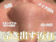 ウル 下北沢(Ulu)の雰囲気(業界最先端技術の毛穴洗浄★長年の黒ずみ悩みも一度で綺麗に!)