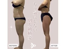 ソワン 小岩店(Soin)/20代　下半身１５回