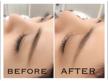 アス(Us)/フラットラッシュ