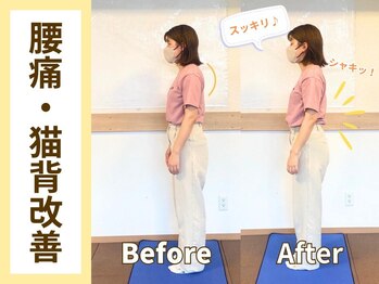 ゲンキ鍼灸整骨院(Genki鍼灸整骨院)/猫背改善