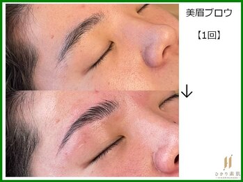 ひかり素肌/美眉ブロウ1回