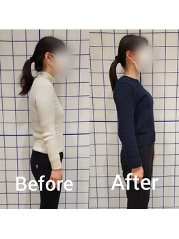 サロンリーベ(salon reve)/40代女性／ねこ背でお悩み