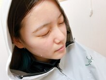 ヨサパーク モア(YOSA PARK Moa)/【施術の流れ】温活痩身ルルオン