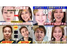 サロンチオリ 烏丸(Salon Chiori)の雰囲気（《小顔とたるみ改善の早道》全身矯正で輪郭を整え肌を引き上げる）