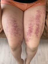 コル コルエ(koru korue)/前モモ使いすぎてませんか?