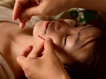 ピュアハリの写真/《笑顔が素敵な女性に変身!》美容鍼でググッとリフトUP◎加齢によるたるみやほうれい線のお悩みを徹底改善!