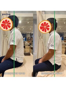 グレフル鍼灸接骨院 整体院 心斎橋/整体/肩こり/マッサージ/腰痛