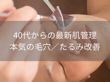 シェノン(Chainon)