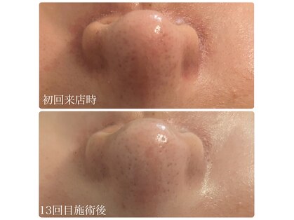 ブリエ(Briller)の写真