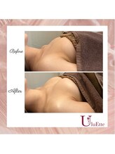 ウルエッテ(UluEtte)/バストのお悩みから卒業したい方
