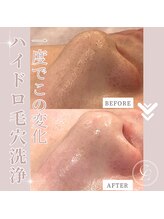 エンルーチェ プラスエイト(en;Luce+8)/