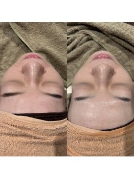 ラシンバン(Lashinvan)/ララピール2回目