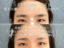 サルレ(Sarule)/左右差悩み1