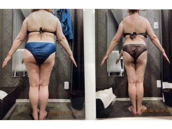 パーフェクトボディプレミアム 名古屋駅前店(PERFECT BODY PREMIUM)/お客様 ビフォーアフター(13)