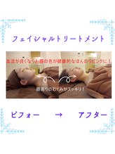 アクアマナ 薬院(AKUA.MANA)/フェイシャル★ビフォーアフター