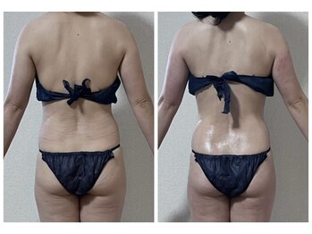 スリー(3Re)/くびれができた！背中美人