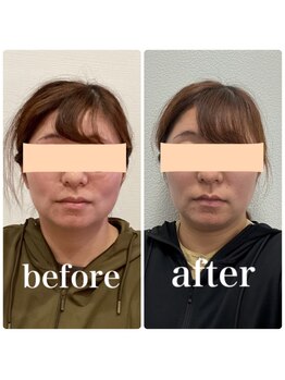 クリーム 京都店(Cream)/