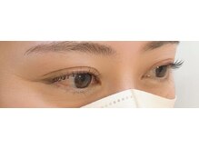 ビート(BEAT)/マツパ