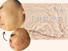 サロン アンネ(Anne)