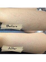 レルア(Relua)/急な予定の前にも…