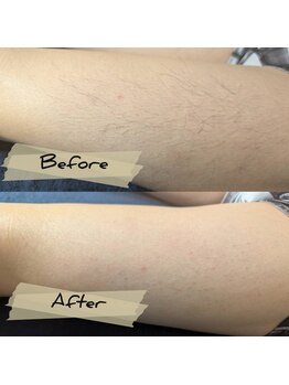 レルア(Relua)/急な予定の前にも…