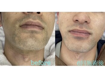 アーク 大河原(Ark)/