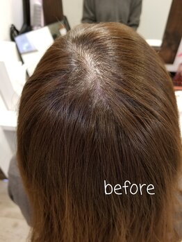 メイユール(meilleurs)/