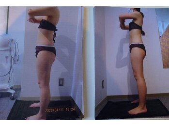 パーフェクトボディプレミアム 神戸三宮店(PERFECT BODY PREMIUM)/お客様 ビフォーアフター(6)