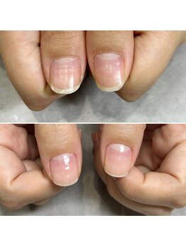 ネイルズシャトン/育爪ビフォーアフター♪