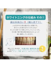 アース 福岡天神店(EARTH)/ホワイトニングの仕組み（1）