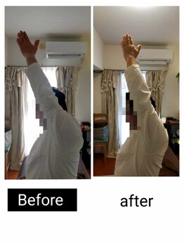 アース エンジェル整体院/ビフォアフ 肩こり ストレッチ