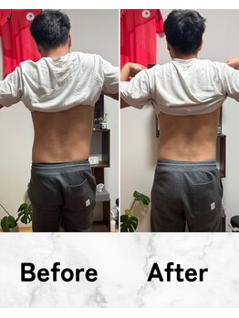 ビルド 横浜(BUILD)/急にくる腰痛も対応します!