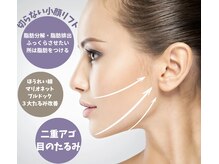 ルピナージュ(Lupinage)