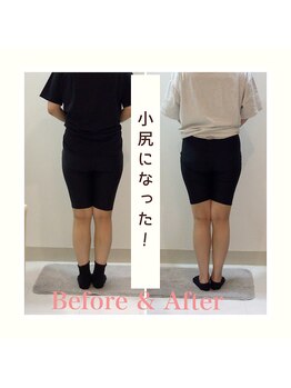 スタイルラボ高松/産後の骨盤矯正の効果♪