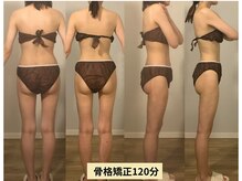 スナオ(sunao)の雰囲気(最先端たるみケア機器♪全顔×肩・首・デコルテハンドで小顔に♪)