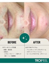 エミレーブ シロカネ(Hemireve Shirokane)/あなただけのスキンマネジメント