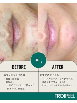 エミレーブ シロカネ(Hemireve Shirokane)/あなただけのスキンマネジメント