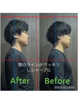 もみらく家/RE:SET