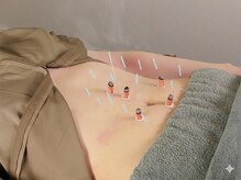 白記漢方堂鍼灸院(HAKU KI)/東洋医学的にみる体質別施術