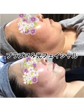 リラクゼーションサロン カネサチ/プラズマ&光フェイシャル