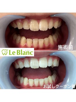 ルブラン 奈良店(Le Blanc)/効果に自信がありますので