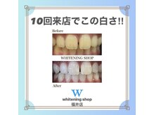 ホワイトニングショップ 福井店/10回でこの白さ！！