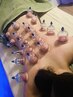 学割Ｕ24【カッピング15分+背中オイル15分】疲労/冷え/ダイエット効果◎