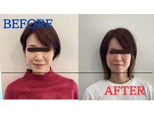 たかす整骨院/小顔/法令線/顔の歪み・たるみ