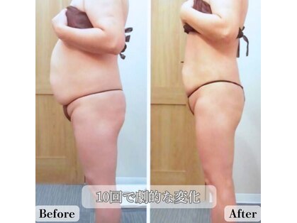 レイプラス イオン卸町店(RAY PLUS)の写真